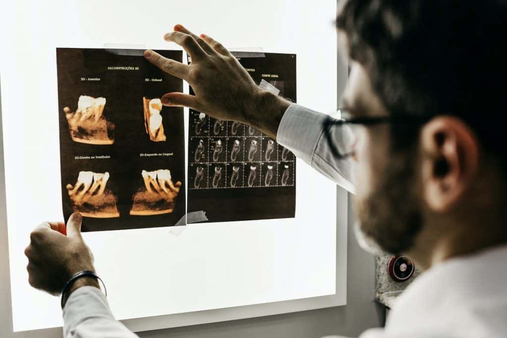impresión 3D en odontología
