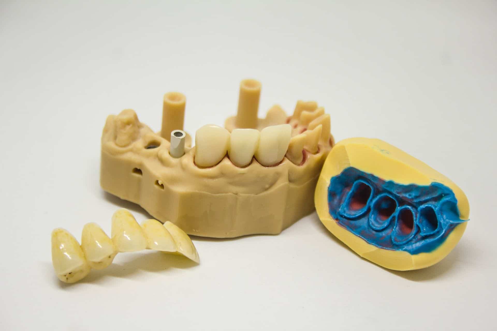impresión 3D en odontología impresión 3D en odontología