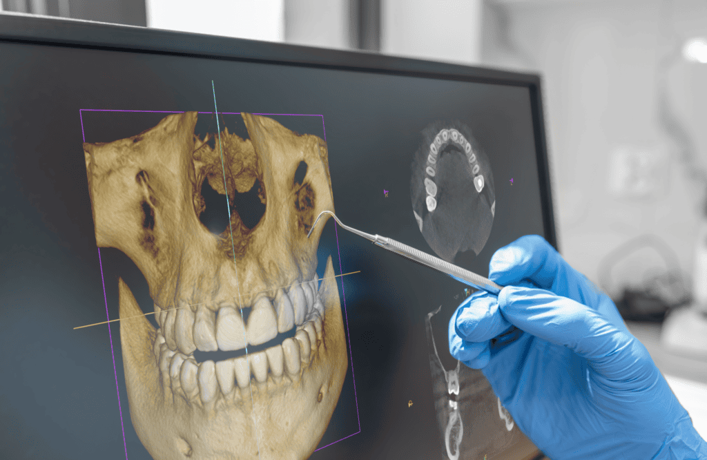Impresión 3D en el Sector Médico