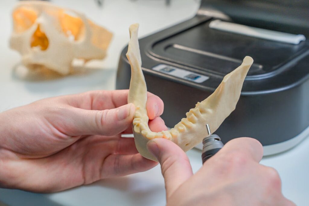 Modelos dentales impresos en 3D en laboratorio — TecnoBro3D Alicante